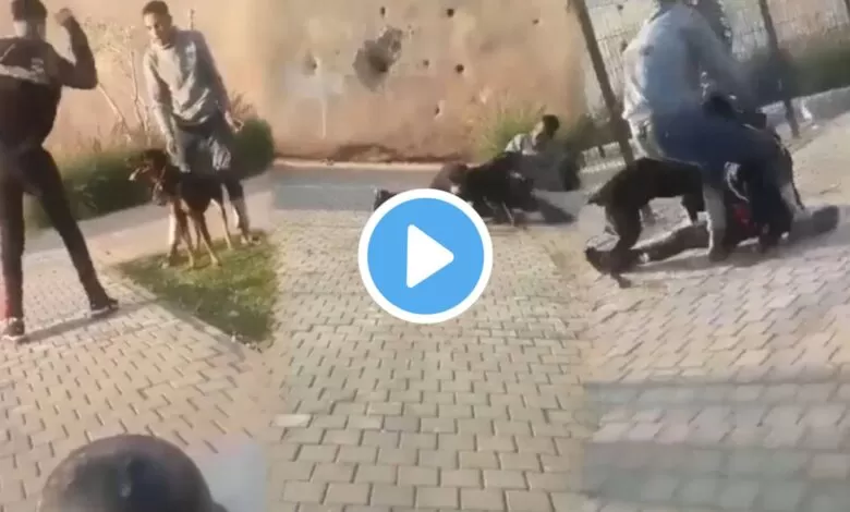 dog attack victim viral video